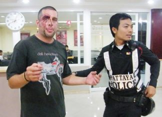 Philip Champreks complains to police about how he was beaten for “having fun” on a baht bus.